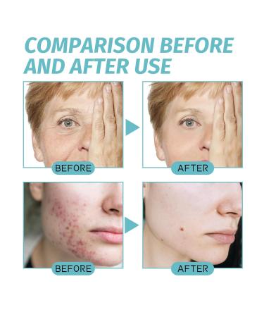 Buy Anti-Aging Face Moisturizer with Collagen & Retinol - Hydrating Cream for Day & Night - Buy Online on GoSupps.com