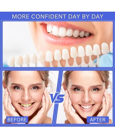 Ikkab Teeth Whitening Strips - 28 Mint Flavor Stripes for Fast Enamel Stain Removal | At-Home Tooth Bleaching - Buy Online on GoSupps.com