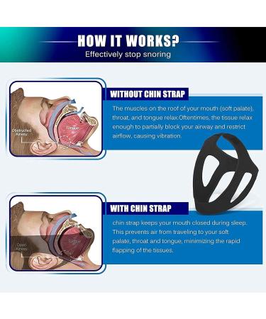 Adjustable Anti Snoring Chin Strap for CPAP Users - Stop Snoring Sleep Aid for Men and Women - X-Large - Buy Online on GoSupps.com
