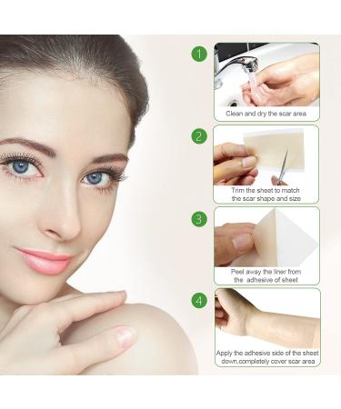 Silicone Scar Sheets for Keloid, Surgical, Burn, and Acne Scars - 10 Soft Long Strips - Buy Online on GoSupps.com