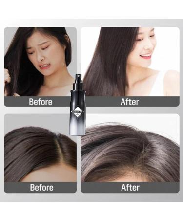 Moutew Hair Leave-in Volumizing Styling Spray Moutew Hair Spray Hair Enhancement Spray 120ml Volumizing Spray for Fine Hair Long-Lasting High Cranial Fluffing Spray for Women Men (5CPS) - Buy Online on GoSupps.com