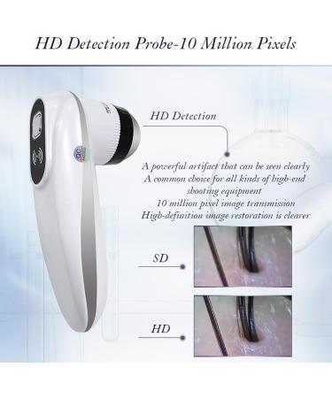 WDDEYYDS Scalp Detector & Hair Analyzer | 5x to 200x Zoom | LCD Display | Ideal for Hairdressing & Beauty Salons - Shop Now! - Buy Online on GoSupps.com