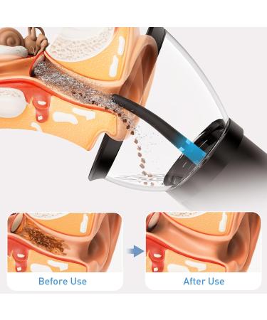 Ear Wax Removal-Electric Ear Cleaner Retractable Ear Cleaning Kit Safe Ear Wax Removal Tool Effective Ear Irrigation Flushing System Waterproof Ear Washer for Humans with 4 Pressure Modes - Buy Online on GoSupps.com