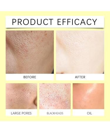 Kojic Acid & Turmeric Pads - Tumeric Kojic Acid Cleansing Pads - Exfoliating Pads for Face & Body - Face Pads for Skincare - Face Exfoliator Pad for Even Skin Tone Pore Cleansing - 30 Pads - Buy Online on GoSupps.com