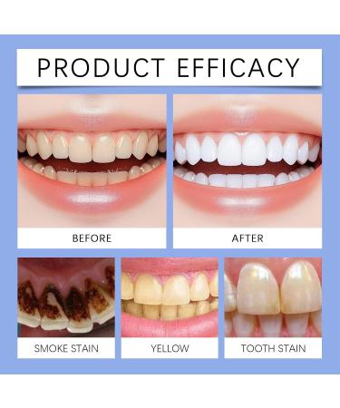 Dentifrice For Le Soin Des Dents - claircit Progressivement Les Dents Renforce L' mail Fra cheur Longue Dur e Nettoyage Quotidien(2PCS) - Buy Online on GoSupps.com