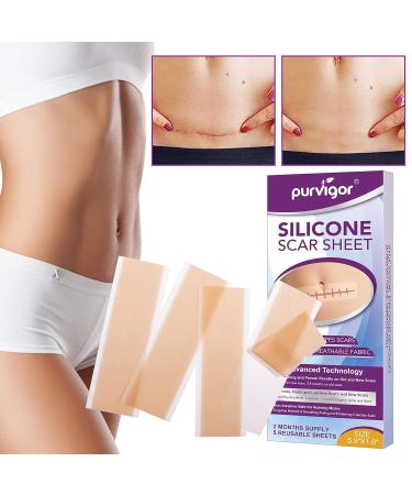 Silicone Scar Removal Sheets (Pack of 4) - 5.9 x 1.6 - Body, Surgical, Burn, Acne & Keloid Treatment - 2 Month Supply - Buy Online on GoSupps.com