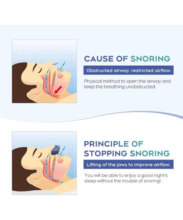 Effective Anti Snoring Devices | Blue-3 Snoring Solutions for Better Sleep - International Shipping - Buy Online on GoSupps.com