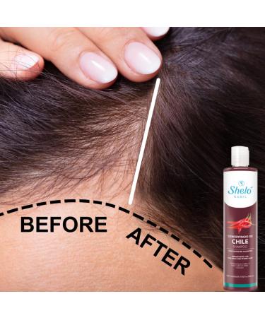 Shelo Nabel Chile Concentrado Shampoo - Strengthens & Brightens Hair | 17.92 fl oz - Shop Internationally - Buy Online on GoSupps.com