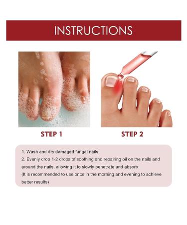 2Pcs German Toenailplus Anti Paronychia Relief Oil - Ingrown Toenail Treatment & Pain Relief for Damaged Thick Nails - Buy Online on GoSupps.com