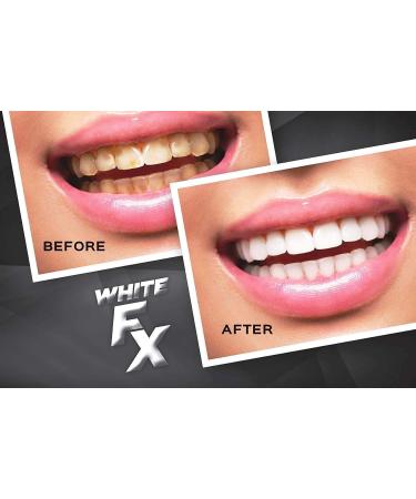 EverWhite Whitening Teeth Whitening Strips - Brighten Your Smile Fast - Buy Online on GoSupps.com
