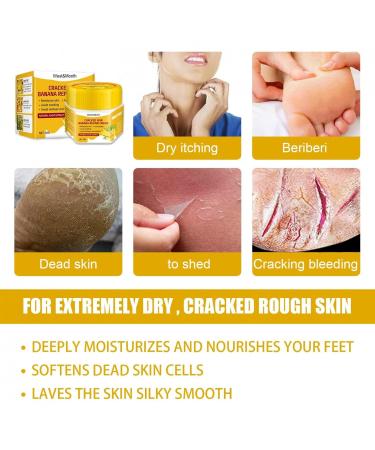 Shea Butter Foot Cream for Very Dry Feet & Cracked Heels - Effective Ointment for Soft Skin | A Size - Buy Online on GoSupps.com