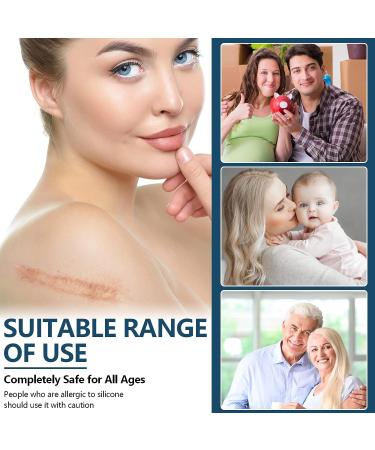 Medical Grade Silicone Scar Sheets - 1.6 x 120 Inch - For Old & New Scars - Safe & Painless Scar Removal - Face, Body, Surgery, C-Section, Keloid, Burn - 7 Months Supply - Buy Online on GoSupps.com
