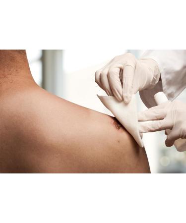 Buy 10x10 Unsteril Wound Compresses - 100 Pieces Immersed Fleece Gauze Bandage | Non-Adhesive Medical Dressing for Wound Care - Buy Online on GoSupps.com