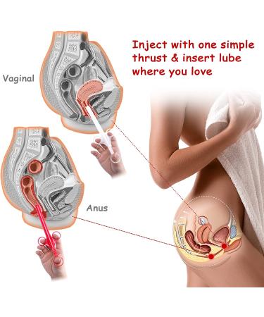 ANGCURE Lube Applicator Syringes - 10ml Lubricant Shooter for Men, Women & Couples - Reusable & Easy to Clean - Red & White - Buy Online on GoSupps.com