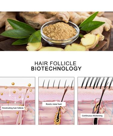 Hair Strengthening Essential Oil for Thinning Hair - Hair Strengthening Oil for Business Travel Home Travel Hair Salon Spa Center Zonewd - Buy Online on GoSupps.com
