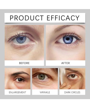 Lumibalm Eye Bag Stick Lumibalm Clears Eye Bags in Minutes Retinol Eye Cream Stick Lumistick Eye Cream Stick (4pcs) - Buy Online on GoSupps.com