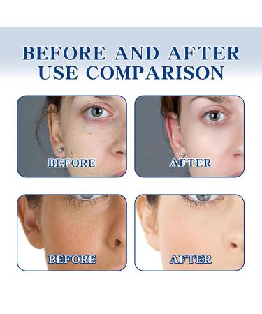 JOYVOIDX Brightening Essence Cream with Arbutin Tocopherol and Hyaluronic Acid Dark Spot Correcting Treatment for Dull Skin Even Tone Moisturizer 1.76 Oz - Buy Online on GoSupps.com