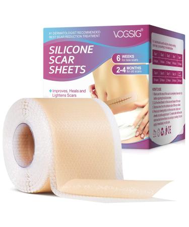 Silicone Scar Sheets Silicone Scar Tape Roll for Scar Removal Reusable Waterproof Professional Soft Silicone Tape (1.6''x75''-1.9M) Yellow