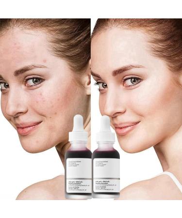 AHA 30%+BHA 2% Face Serum AHA Serum for Hydrated BHA Exfoliating Solution Hyalu B5 Serum AHA &BHA Serum to Reduce Fine Line and Minimise Pore Facial Serum Dark Spot Remover for Face Brightening Serum - Buy Online on GoSupps.com