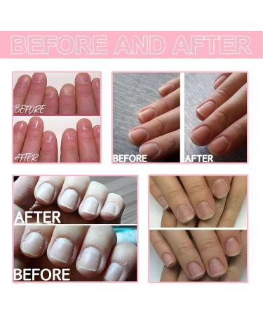 Saluaqui Nail Cuticle Care Kit Strengthens Weak Nails Trimming Tool Included Cuticle Remover Kit Safe Ingredients Easy to Use for Nourishing and Hydrating for DIY Nail LS152-2 - Buy Online on GoSupps.com