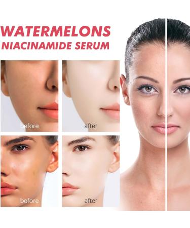 Watermelon Serum with Hyaluronic Acid & Niacinamide - Deep Hydration - Brightening & Pigmentation Reduction - Buy Online on GoSupps.com