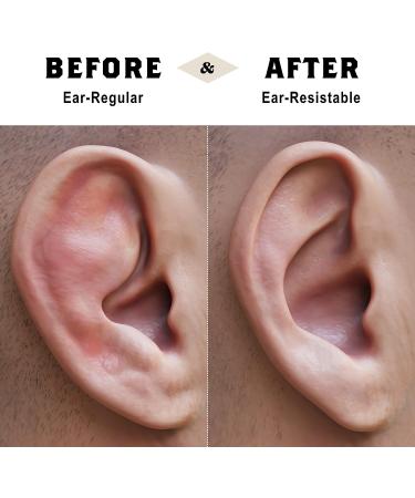 Earlox Cauliflower Ear Magnets - Effective Magnetic Solution for Hematomas - Buy Online on GoSupps.com