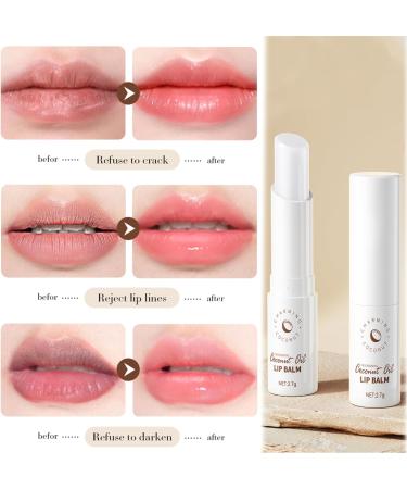 Virecose Lip Balm 6 Lip Care Balm for Dry Lips 5 g - Buy Online on GoSupps.com