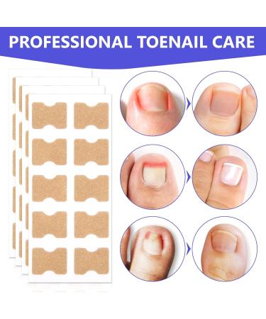 Toen il Correction Sticker 100Pcs: N il Repair P tches Restores Appearance of Discolored or Damaged Nails Foot Care - Buy Online on GoSupps.com