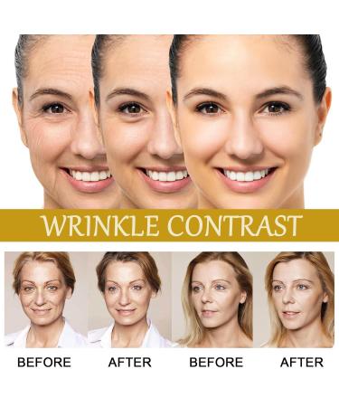 Advenced Bee Venom Anti-Wrinkle Essence Anti-aging Serum With Multi Peptide Hyaluronic Acid Triple Action Serum Repair Moisturize and Firm Face Skin (2 Pack) - Buy Online on GoSupps.com