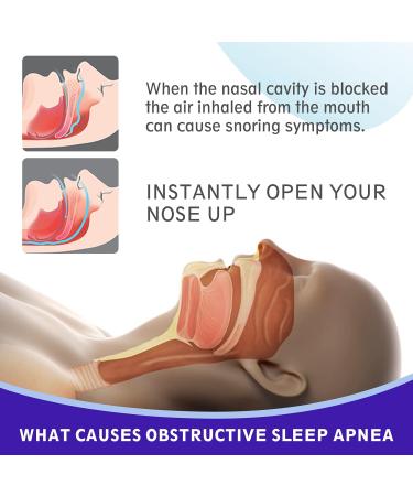 Nose Plaster Snoring Solution - Anti-Snore Nasal Strips for Blocked Nose Relief (30 Pieces) - Drug-Free Extra Strong for Sports & Sleep - Buy Online on GoSupps.com