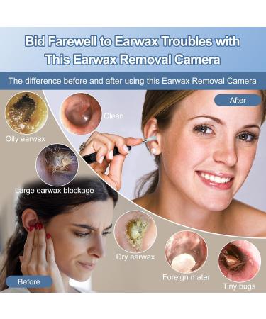 Ear Wax Removal Ear Cleaner with 1080P HD Camera with 6 LED Lights/IP67 Waterproof Lens/8 Traditional Tools Ear Wax Removal Kit Rechargeable Ear Cleaning kit for iOS Android Tablet (Black03) - Buy Online on GoSupps.com