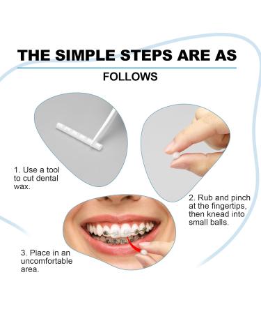 Buy Colorful Braces Wax - 20 Pack (Vitamin E Aloe Vera Mint) | Orthodontic Wax & Storage Cases for Braces Wearers - Buy Online on GoSupps.com