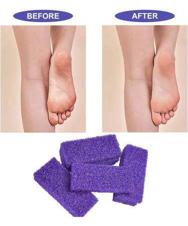 Pumice Stone for Feet Exfoliation - 10 Pcs, Dual Sided Foot Scrub for Hard Skin & Callus Removal - Ideal for Home & Salon Use - Buy Online on GoSupps.com