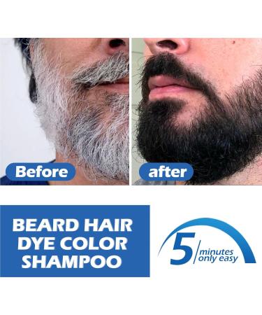 Kit Pousse Barbe avec Roller Huiles de Croissance de Barbe 100ML 1PC Appliquer sur les Cheveux Barbe Coloration Uniforme Entretien des Cheveux secs Fourche - Buy Online on GoSupps.com