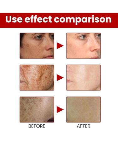 Vjeybv Skin Lightening Cream - Lightening Cream for Face Underarm Cream Natural Black Spots Brightening Cream for Body Underarms Armpit Knees Legs and Inner Thigh Cream - Buy Online on GoSupps.com