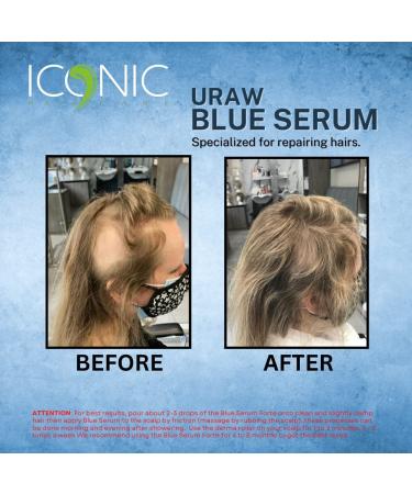 URAW Blue Serum 100ml - Effective Hair Growth & Anti-Hair Loss Serum | New Bottle for International Shipping - Buy Online on GoSupps.com
