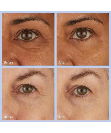 Buy skyn ICELAND Hydro Cool Eye Pads - 12 Pairs for Firming Tightening & Relaxing Under Eye Skin | International Shipping Available - Buy Online on GoSupps.com