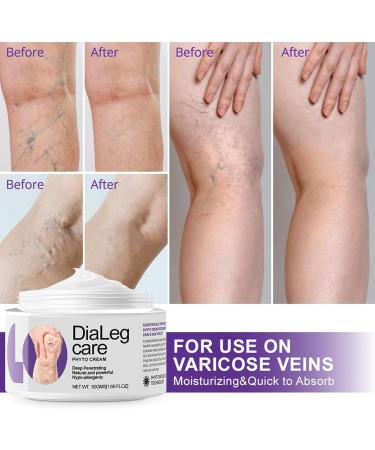 PHFTRCEW Ourlyard DiaLeg Care Cream Professional Leg Treatment Cream Ourlyard Leg Care Ointment Natural DiaLeg care Specialist 1Pcs - Buy Online on GoSupps.com