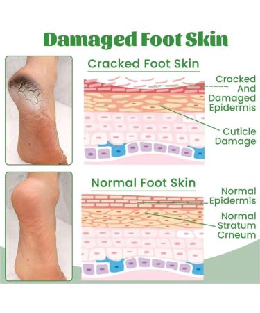 Heel Repair and Moisturizing Cream Fast Absorbing Repair and Moisturizing Dry Feet Foot Repair and Moisturizing Cream Healing Ointment for Cracked Heels - Buy Online on GoSupps.com