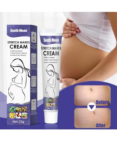 SINGOVE Scar Removal Cream - All-Natural Maternity Stretch Mark Prevention & Remover for Pregnant Women - Fades Scars, Wrinkles & Promotes Healthy Skin - Perfect Skincare Gift for Moms - One Size - Buy Online on GoSupps.com