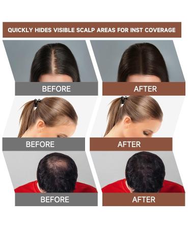 Mifeloy Hairline Powder (2 Pieces) with Mirror & Sponge - Brown Waterproof Concealer for Hair - Instant Effect Hair Sealing Makeup for Men & Women - Buy Online on GoSupps.com