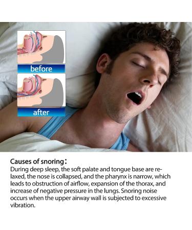 100Pcs Breathe Original Nasal Strips for Sensitive Skin - Reduce Snoring & Mouth Breathing - Promote Sleep - Nose Patches for Colds and Allergies - Buy Online on GoSupps.com