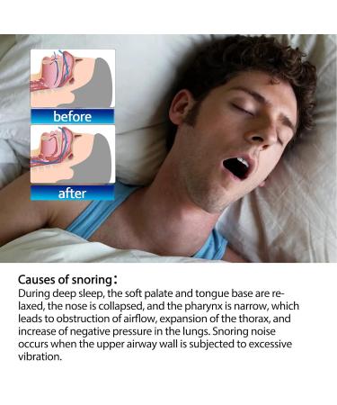 Snoring Nasal Strips - Natural Relief for Better Sleep and Reduced Stress - Buy Online on GoSupps.com