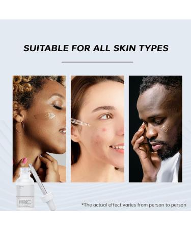 Niacinamide Serum for Face - 10% Niacinamide + 1% Zinc | Best Acne Treatment - 30ML - Buy Online on GoSupps.com