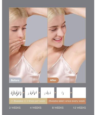 INNZA Laser Hair Removal Device - Upgraded 999999 Flashes IPL with Sapphire Ice Cooling - Permanent Hair Removal for Women and Men - Depiladora Laser for Facial & Body - Corded Black - Buy Online on GoSupps.com