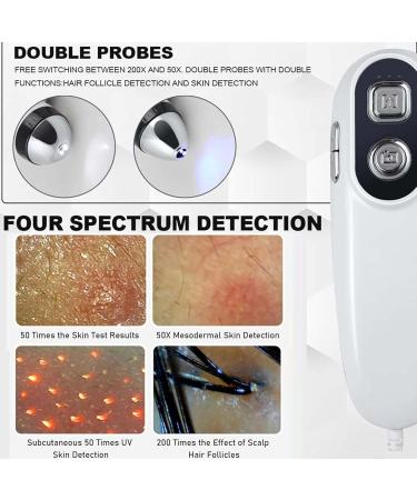Hair Follicle Analyzer: High-Resolution 11" Scalp Detector with 10MP Camera 50x+200x Magnification for Testing Scalp Oil & Hair Moisture - Buy Online on GoSupps.com