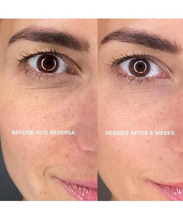 Vice Reversa Eye Rejuvenator - Hyaluronic Acid Under Eye Patches for Hydration & Brightening - MicroCrystal Skincare (12 Pairs) - Buy Online on GoSupps.com