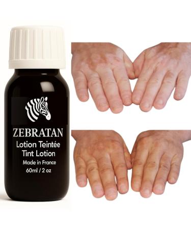Zebratan Zebratan Custom Vitiligo Makeup - 60ml Light Beige - Camouflage Patches - Sunscreen Lotion - Non-Greasy No Foundation