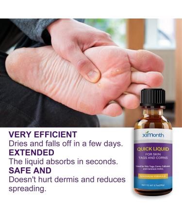 Wart Remover Liquid Fast Acting Salicylic Liquid to Remove Common and Plantar Warts Flat Warts 0.7 Fl Oz 1 Count - Buy Online on GoSupps.com