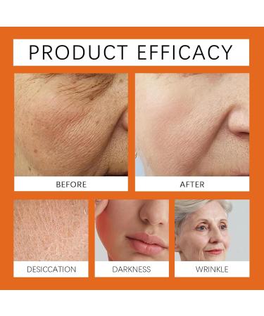 APKAPK Bee Venom Comprehensive Cream Advanced Firming & Wrinkle-Reducing cream Natural Bee Venom Skin Treatment Cream Suitable for All Skin Types (1Pcs) - Buy Online on GoSupps.com